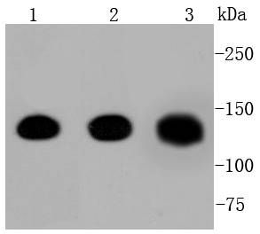 Pan-Cadherin Rabbit mAb