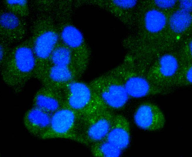 Chk1 Rabbit mAb