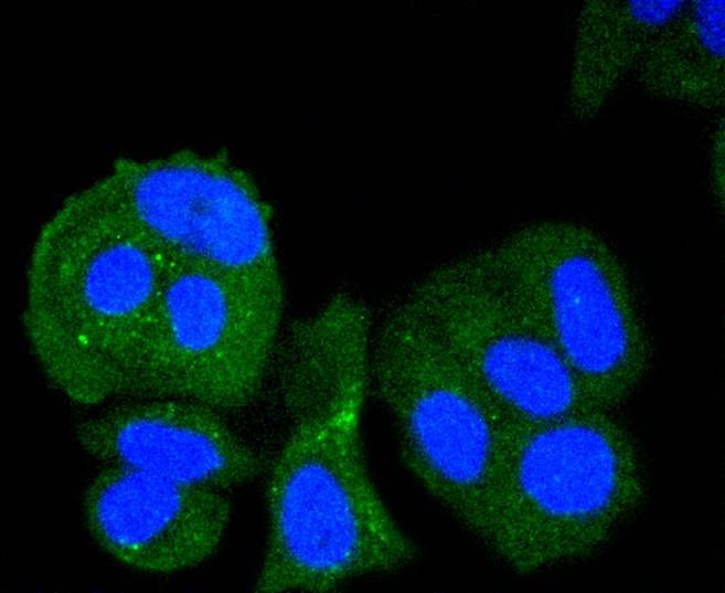 Chk1 Rabbit mAb