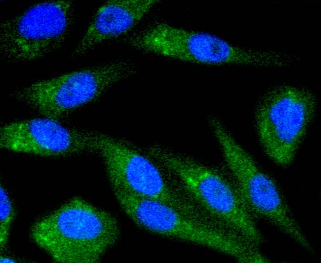 Chk1 Rabbit mAb