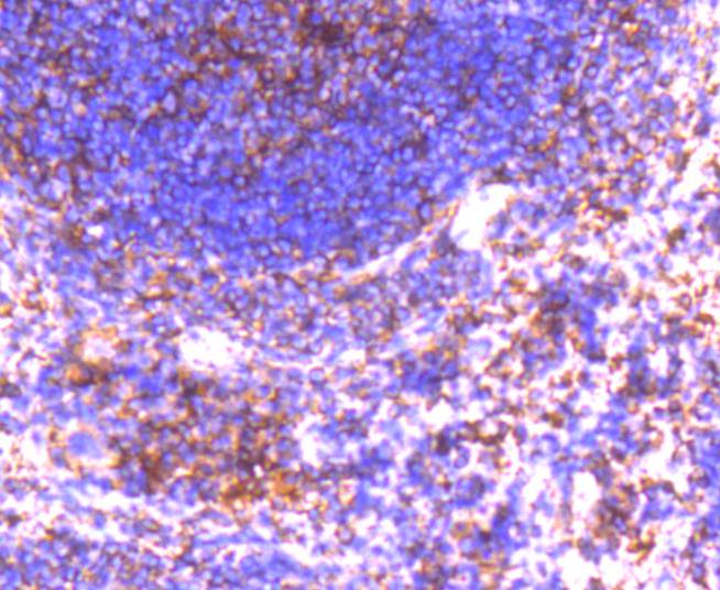 GRK2 Rabbit mAb