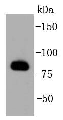 GRK2 Rabbit mAb