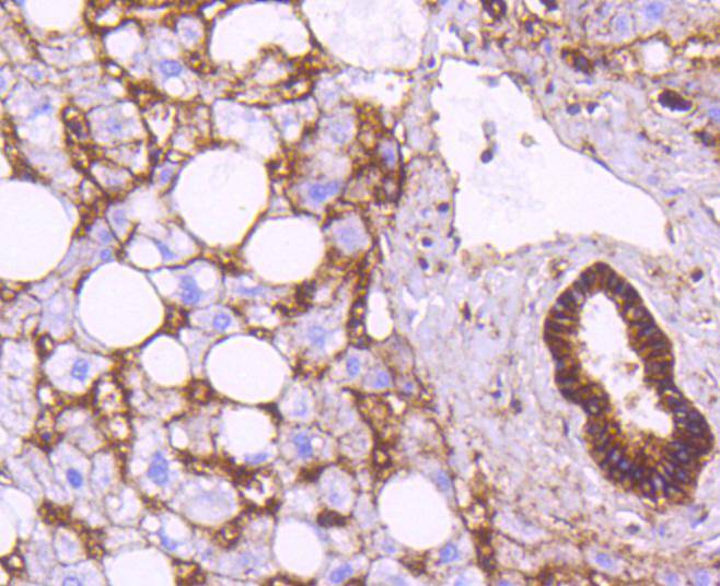 Sodium Potassium ATPase Rabbit mAb