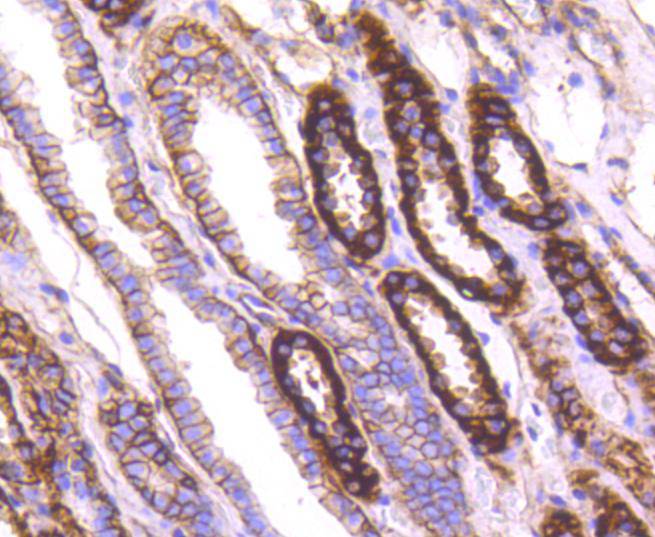 Sodium Potassium ATPase Rabbit mAb