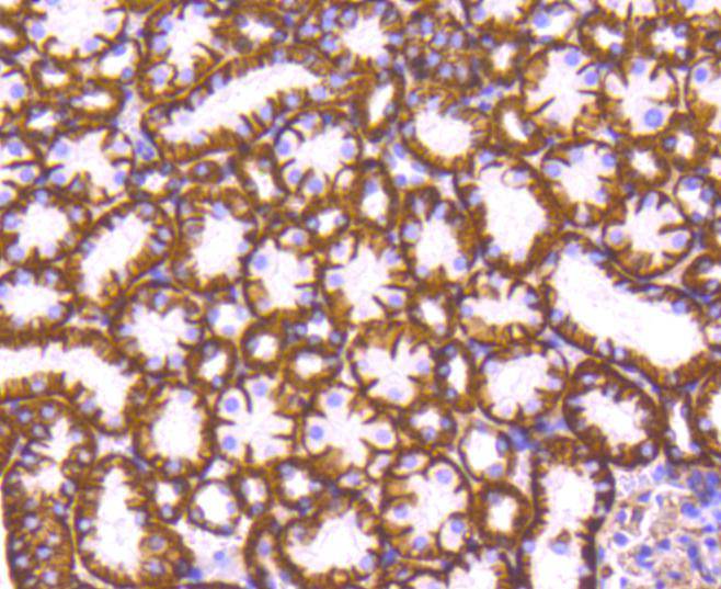 Sodium Potassium ATPase Rabbit mAb