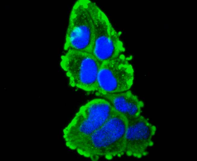 Cytokeratin 16 Rabbit mAb