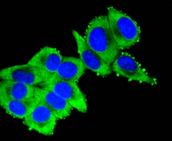 Cytokeratin 16 Rabbit mAb