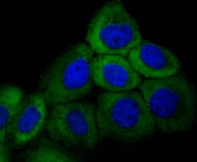 Cytokeratin 16 Rabbit mAb