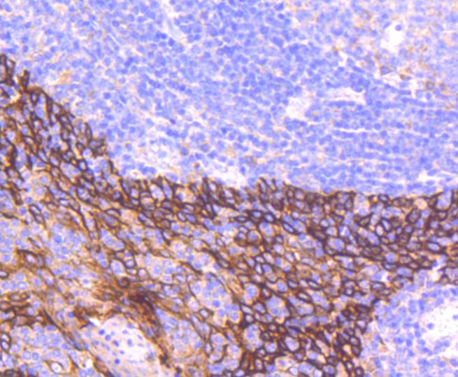 Cytokeratin 16 Rabbit mAb