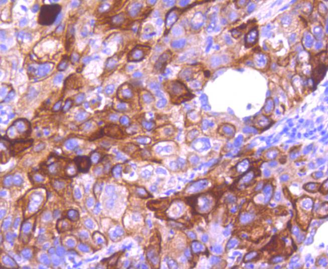 Cytokeratin 16 Rabbit mAb