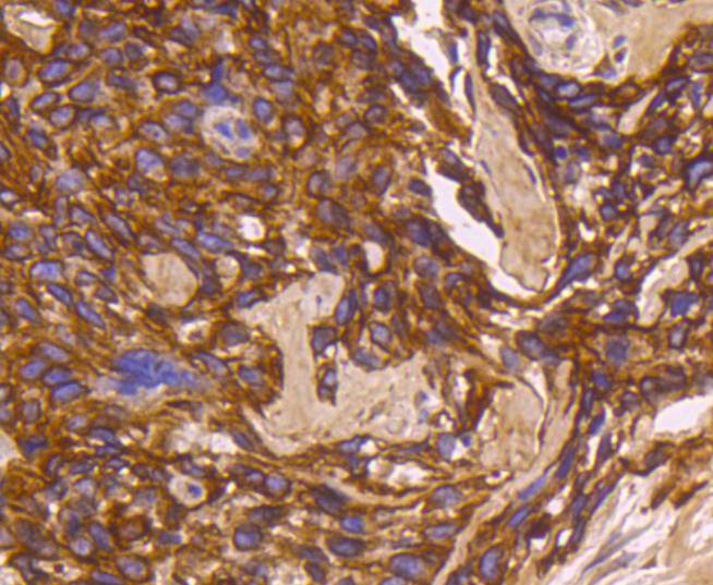 Cytokeratin 16 Rabbit mAb