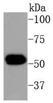 Cytokeratin 16 Rabbit mAb