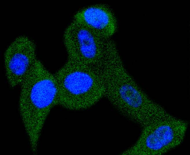 PBP Rabbit mAb