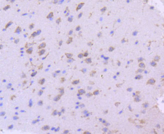 SGK1 Rabbit mAb