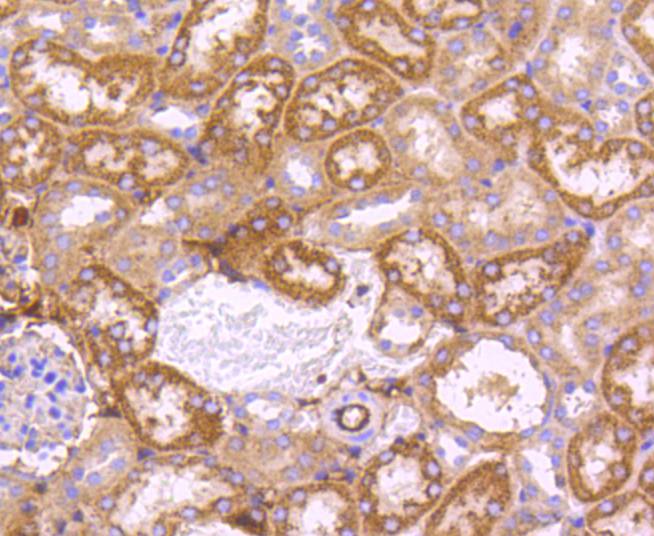 SGK1 Rabbit mAb