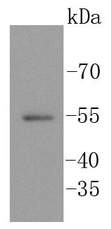 SGK1 Rabbit mAb