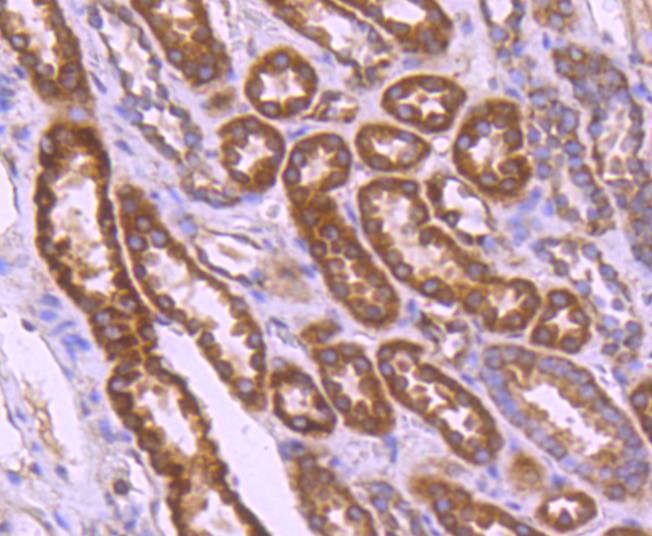 BCL2A1 Rabbit mAb