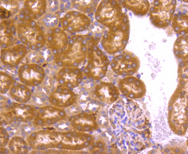 BCL2A1 Rabbit mAb