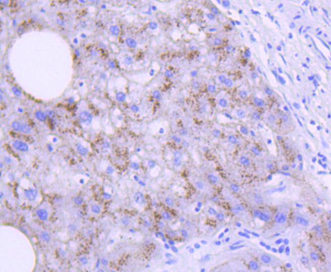 Apolipoprotein E Rabbit mAb