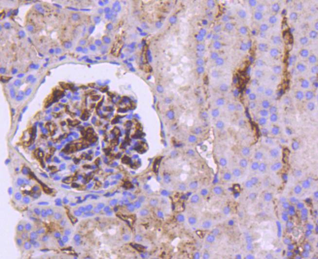 Apolipoprotein E Rabbit mAb