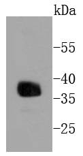 Apolipoprotein E Rabbit mAb