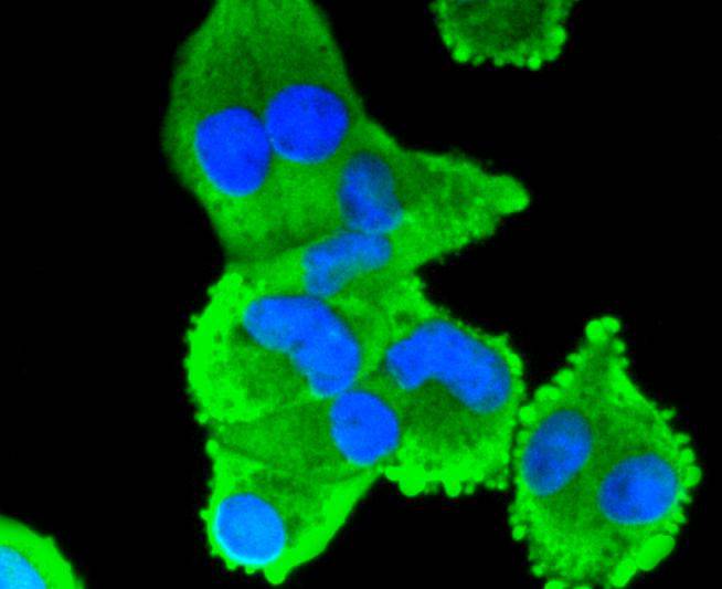 COX2/Cyclooxygenase 2 Rabbit mAb