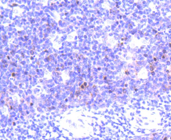 Aurora B Rabbit mAb