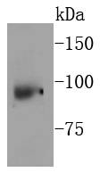 p95 NBS1 Rabbit mAb