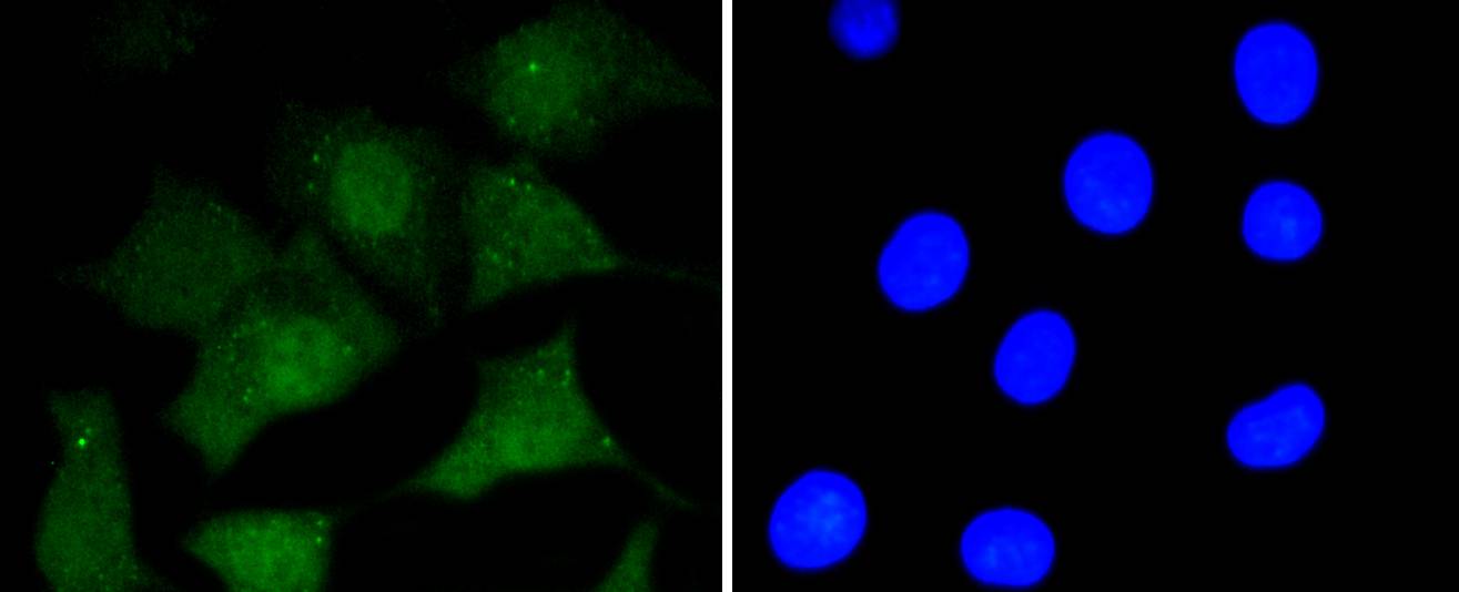 Prion Protein(PrP) Rabbit mAb