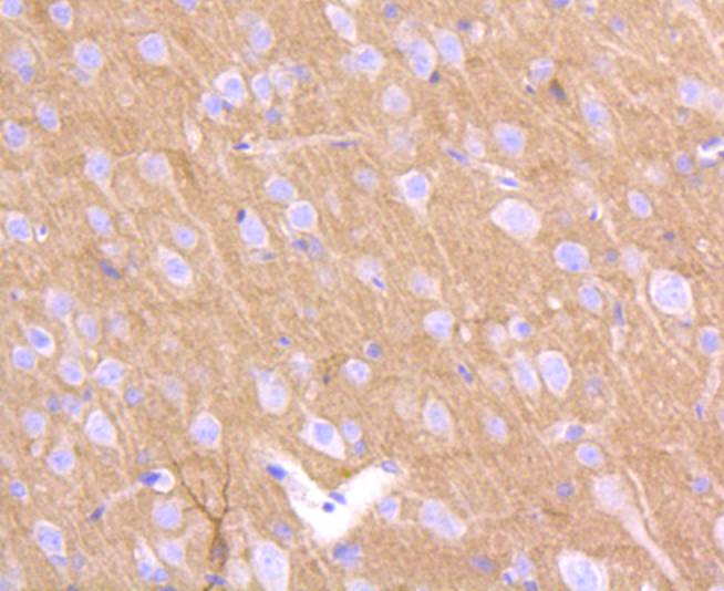 Prion Protein(PrP) Rabbit mAb