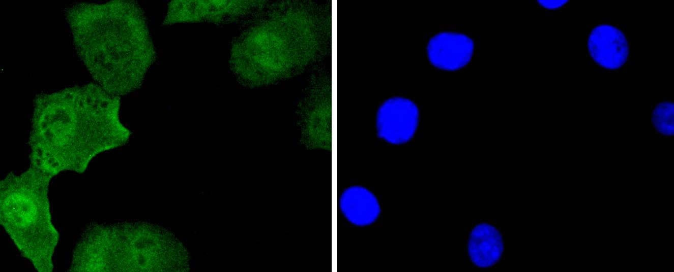 Islet 1 Rabbit mAb