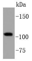 PI3-kinase p110 subunit beta Rabbit mAb