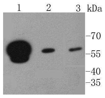 hnRNP K Rabbit mAb