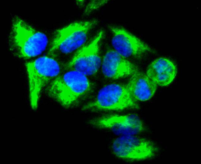 Vimentin Rabbit mAb