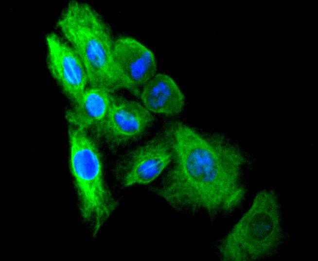 Vimentin Rabbit mAb