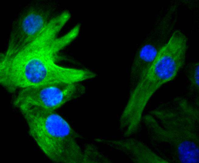 Vimentin Rabbit mAb