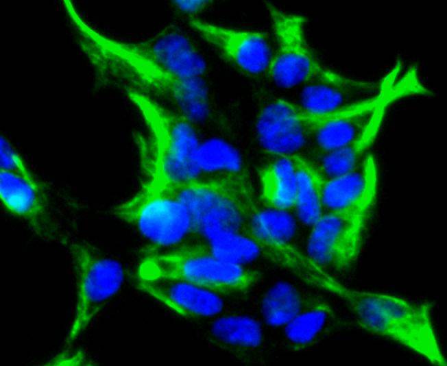 Vimentin Rabbit mAb