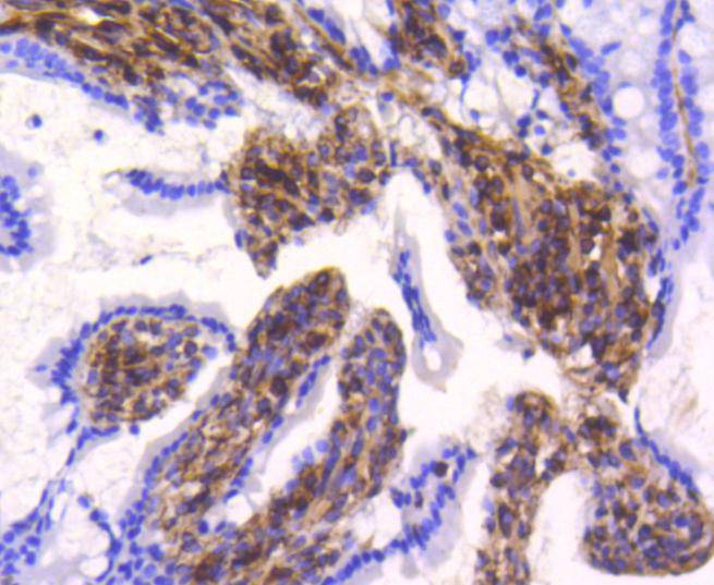 Vimentin Rabbit mAb