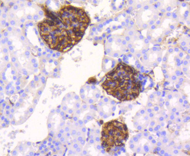 Vimentin Rabbit mAb