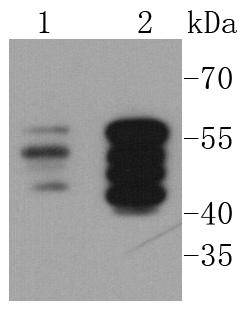 Vimentin Rabbit mAb