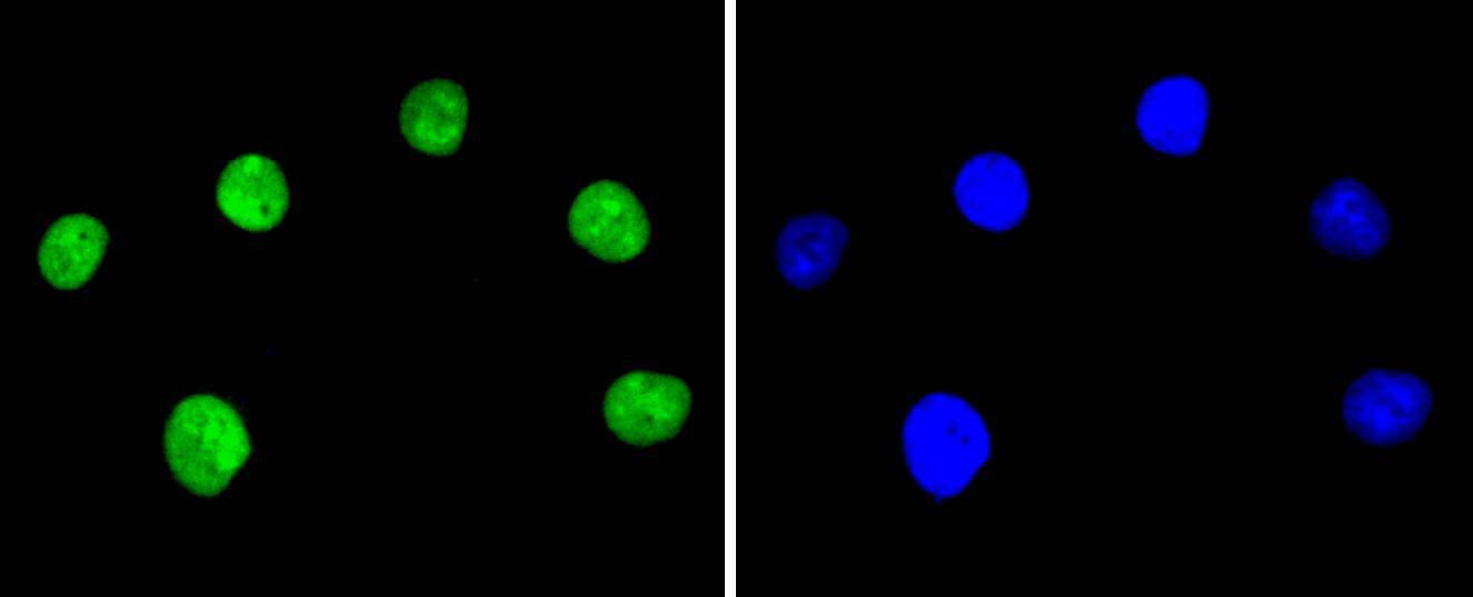 Ku80 Rabbit mAb