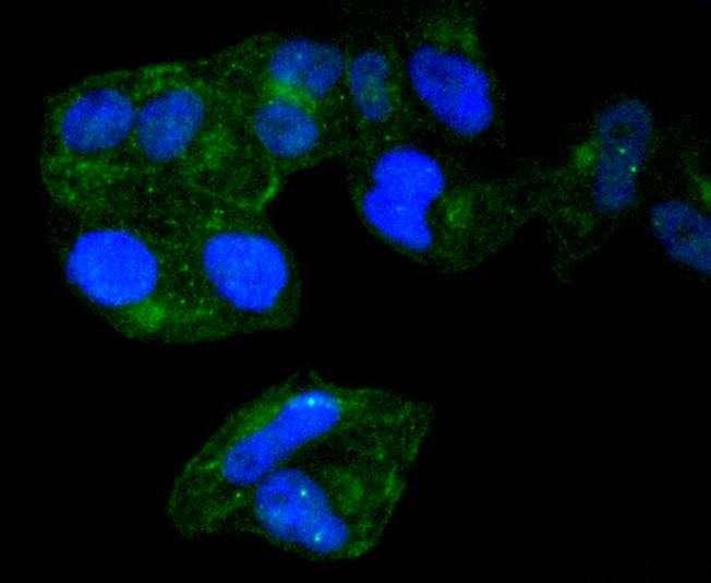 Radixin Rabbit mAb