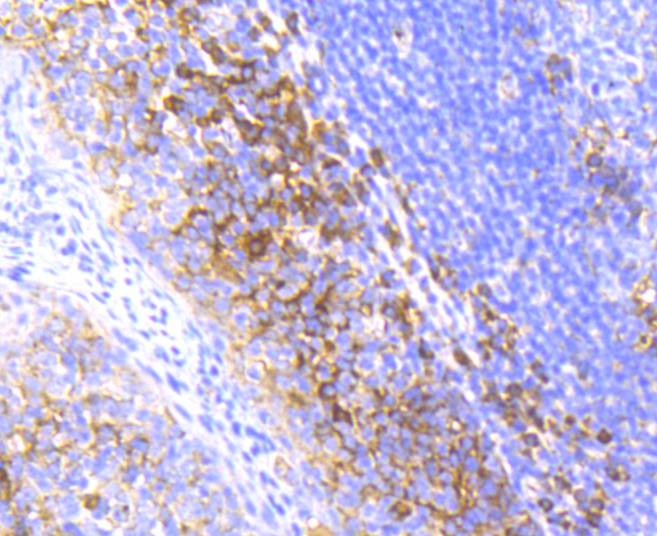 Radixin Rabbit mAb