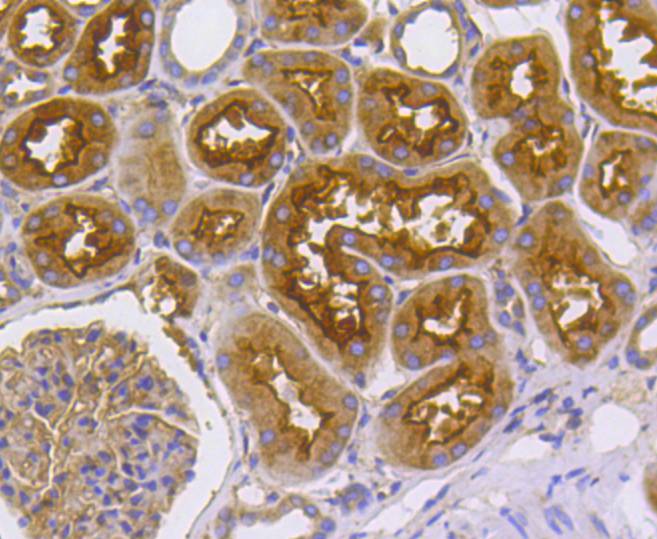 Radixin Rabbit mAb