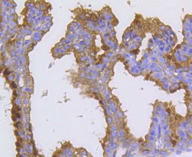 Radixin Rabbit mAb