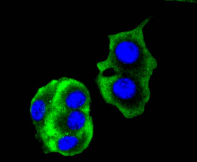 Cytokeratin 14 Rabbit mAb