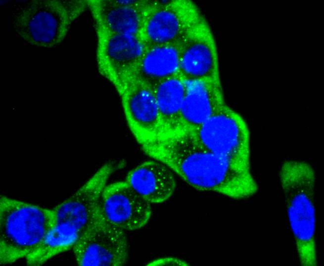 Cytokeratin 14 Rabbit mAb