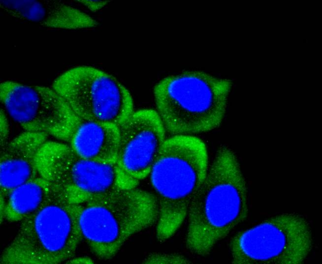 Cytokeratin 14 Rabbit mAb