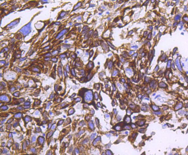 Cytokeratin 14 Rabbit mAb