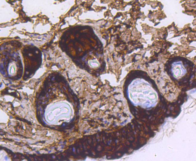 Cytokeratin 14 Rabbit mAb